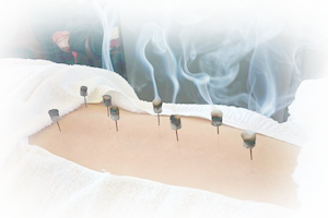 山口鍼灸整骨院